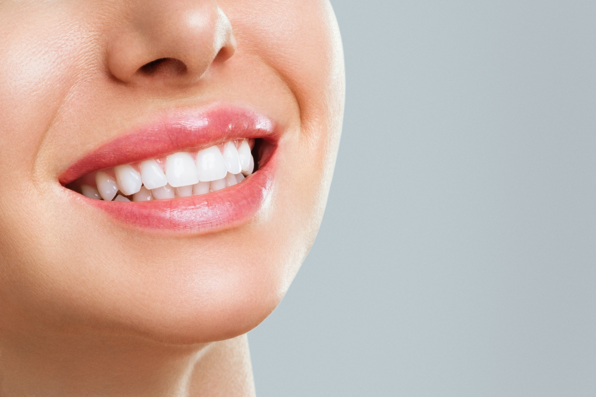 teeth-whitening-in-Glendora-CA
